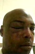Georgia-prisoner-Smith-State-Prison-beaten-by-guards-courtesy-Final-Call, Locked down, exploited and mistreated, Abolition Now! 