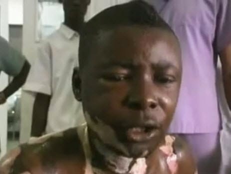 Cedrick-Nianza-121611-vid-by-TheYandimosi, A young man set himself on fire in Boma, Democratic Republic of the Congo, and becomes a martyr of the Congolese Revolution, World News & Views 