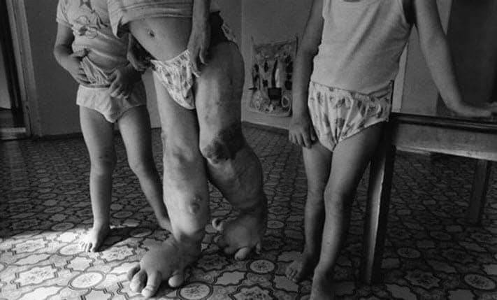 Chernobyl-orphans-20-yrs-later-Belarus-by-Paul-Fusco, Fukushima and the nuclear pushers, World News & Views 