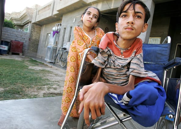 Fallujah-victims-of-US-toxic-bombing-Anas-Hamed-his-sister-Inas, The Blue Angels air show: San Francisco’s choice, Local News & Views 