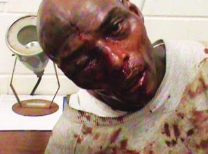 Kelevin-Stevenson-Georgia-prisoner-beaten-with-hammer-by-guards-123110-300x222, Why we’re about to see the largest prison strike in history, Behind Enemy Lines 