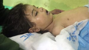 Syrian-baby-treated-after-chemical-attack-040417-by-CNN-1-300x169, Weapons of mass deflection, World News & Views 