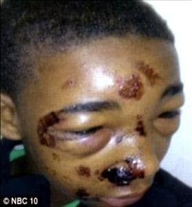 Tullytown-PA-PD-tasered-14-yr-old-Joseph-Williams-in-face-for-his-safety-1113-279x300, Tasers kill, but not in San Francisco: Community, unified for 13 years, suffers setback at Police Commission, Local News & Views 