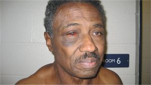 Herman-Bell-a-week-after-beating-by-6-guards-at-Great-Meadow-CF-090517-300x168, Herman Bell granted parole – but cops, politicians try to nix it, Behind Enemy Lines 
