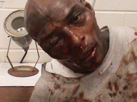 Kelvin-Stevenson-Georgia-prisoner-beaten-with-hammer-by-guards-123110, Video released of Georgia guards beating prisoners with hammer, Abolition Now! 