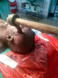 Congo-child-hatchet-murdered-by-Ugandan-Rwandan-militias-in-Beni-No.-Kivu-101614-225x300, Tired of being gang raped, Congo mother takes up weapon, World News & Views 
