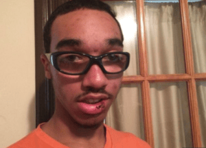 Marcus-Abrams-17-autistic-after-police-assault-0915-by-Adrienne-Broaddus-KARE-300x216, Sister shares story about police profiling and beating her autistic brother, News & Views 