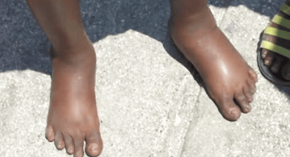 Young-pregnant-woman-in-Lasalin-with-swollen-feet-1, The Lasalin Massacre and the human rights crisis in Haiti, World News & Views 