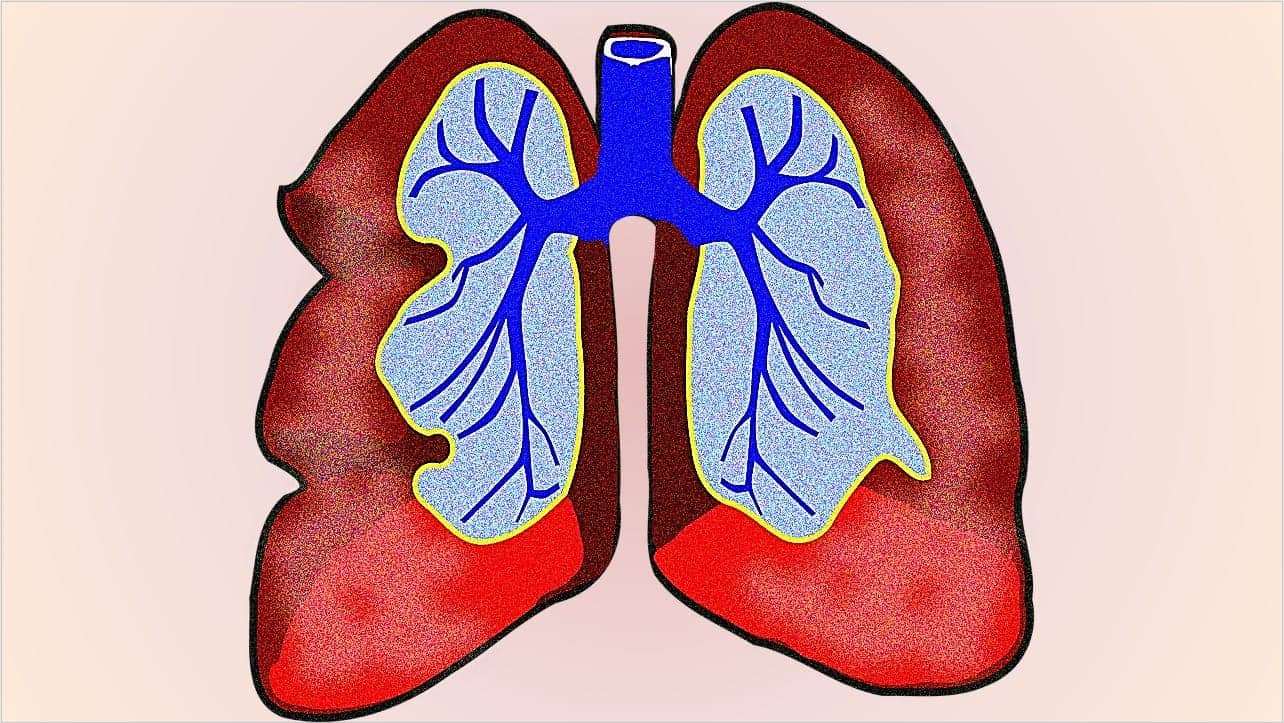 Healthy-lungs-graphic, Perfect storm: First wave of the COVID-19 pandemic crashes in Southeast San Francisco, Local News & Views 