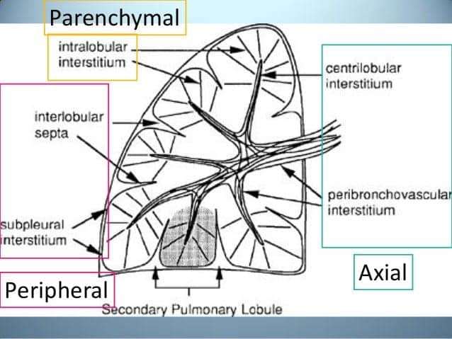 Pulmonary-interstitium-part-of-the-lungs’-anatomy, Perfect storm: First wave of the COVID-19 pandemic crashes in Southeast San Francisco, Local News & Views 