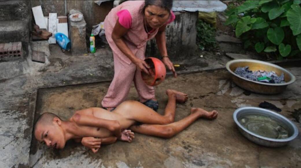vietnamese-agent-orange-legacy, Commemoration of the 50th anniversary of the end of the Vietnam War, World News & Views vietnamese-agent-orange-legacy, Commemoration of the 50th anniversary of the end of the Vietnam War, World News & Views