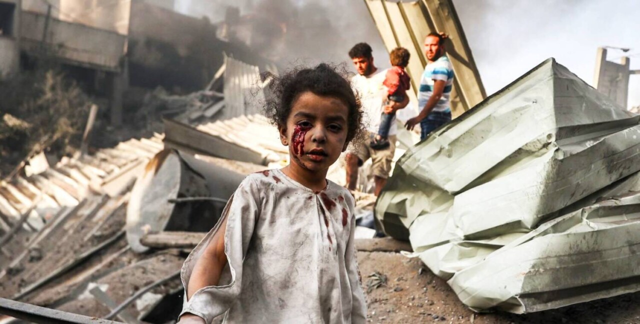 injured-black-gazan-child-in-rubble-by-aa, Study finds Israel ‘disappeared’ at least 377,000 Palestinians in Gaza, half of them children, World News & Views 